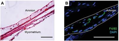 Healing Mechanism of Ruptured Fetal Membrane